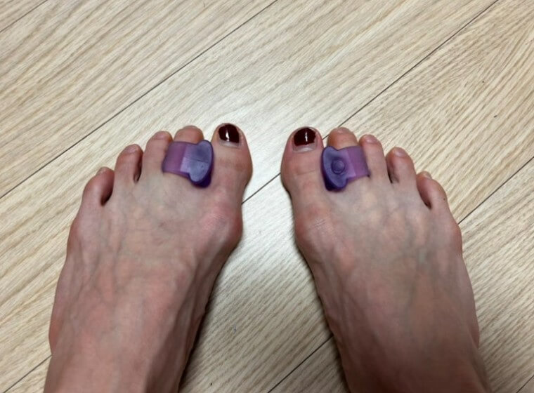 무지외반증 교정기 실리콘형