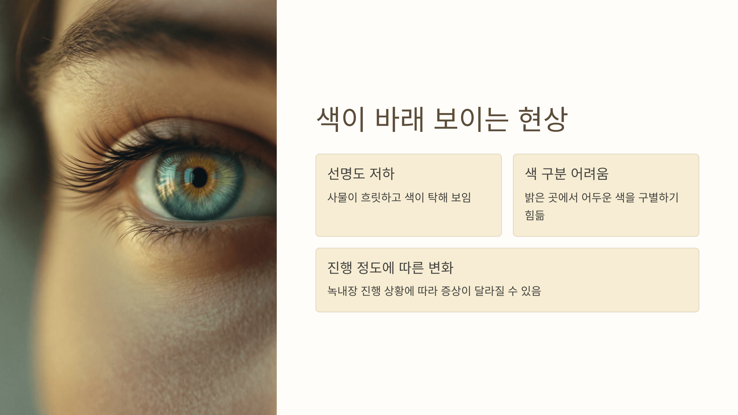 녹내장과 관련된 사진입니다.