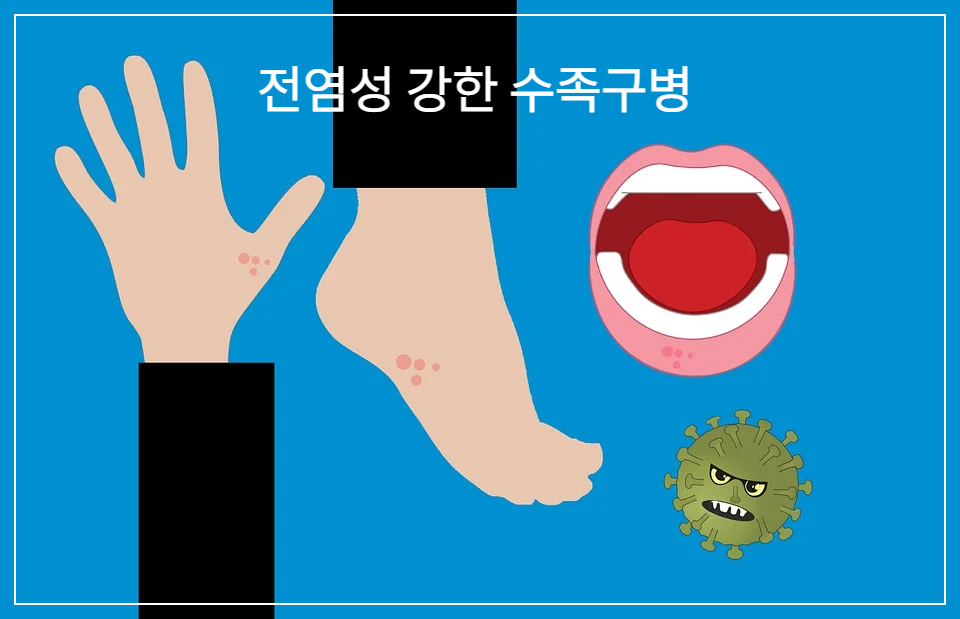 손, 발, 입의 발진, 물집-수족구병