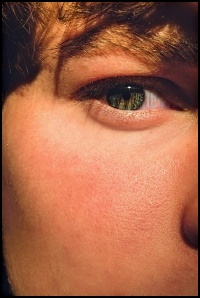 검 버섯 없애는방법