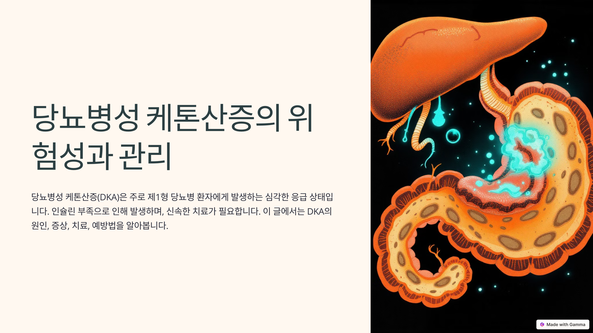 당뇨병성 케톤산증