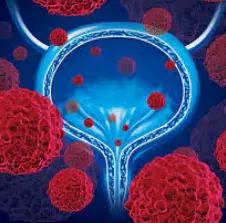 방광염-증상-건강