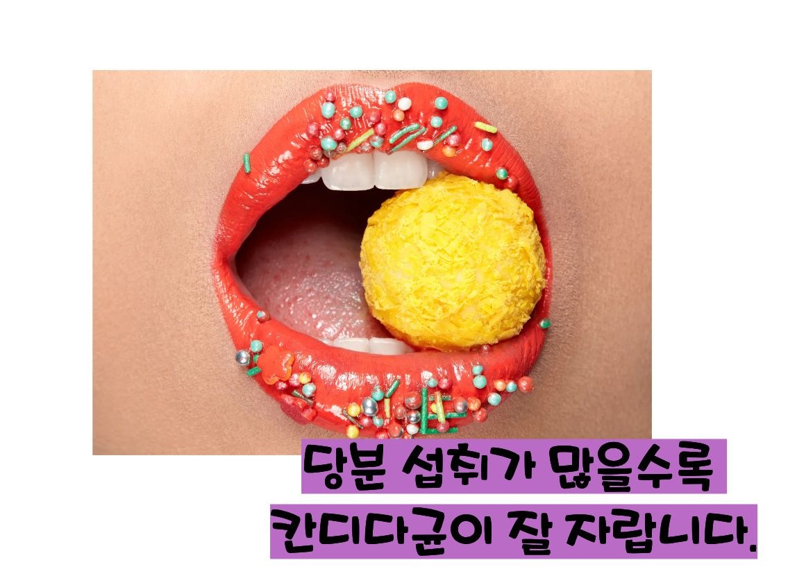 칸디다 질염 원인