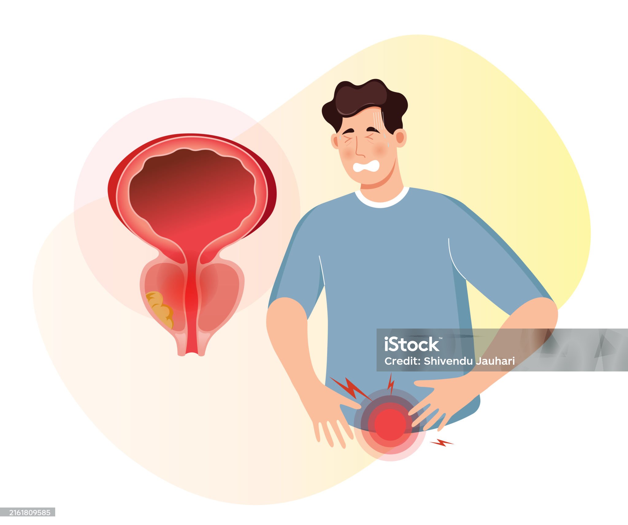 전립선염-관련-사진