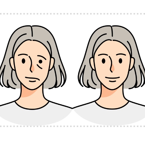 구안와사 원인 초기증상, 증상