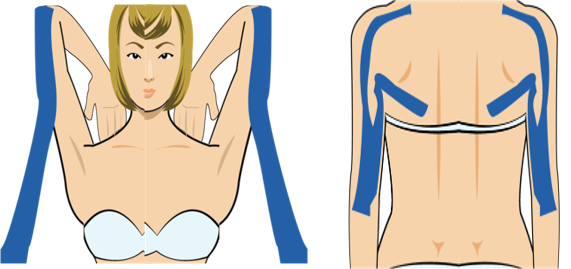 어깨 위 통증 (나른함)