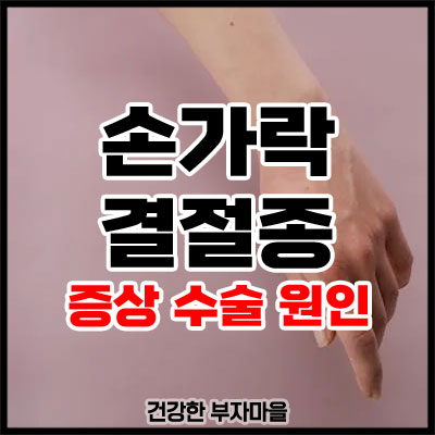 손가락 결절종