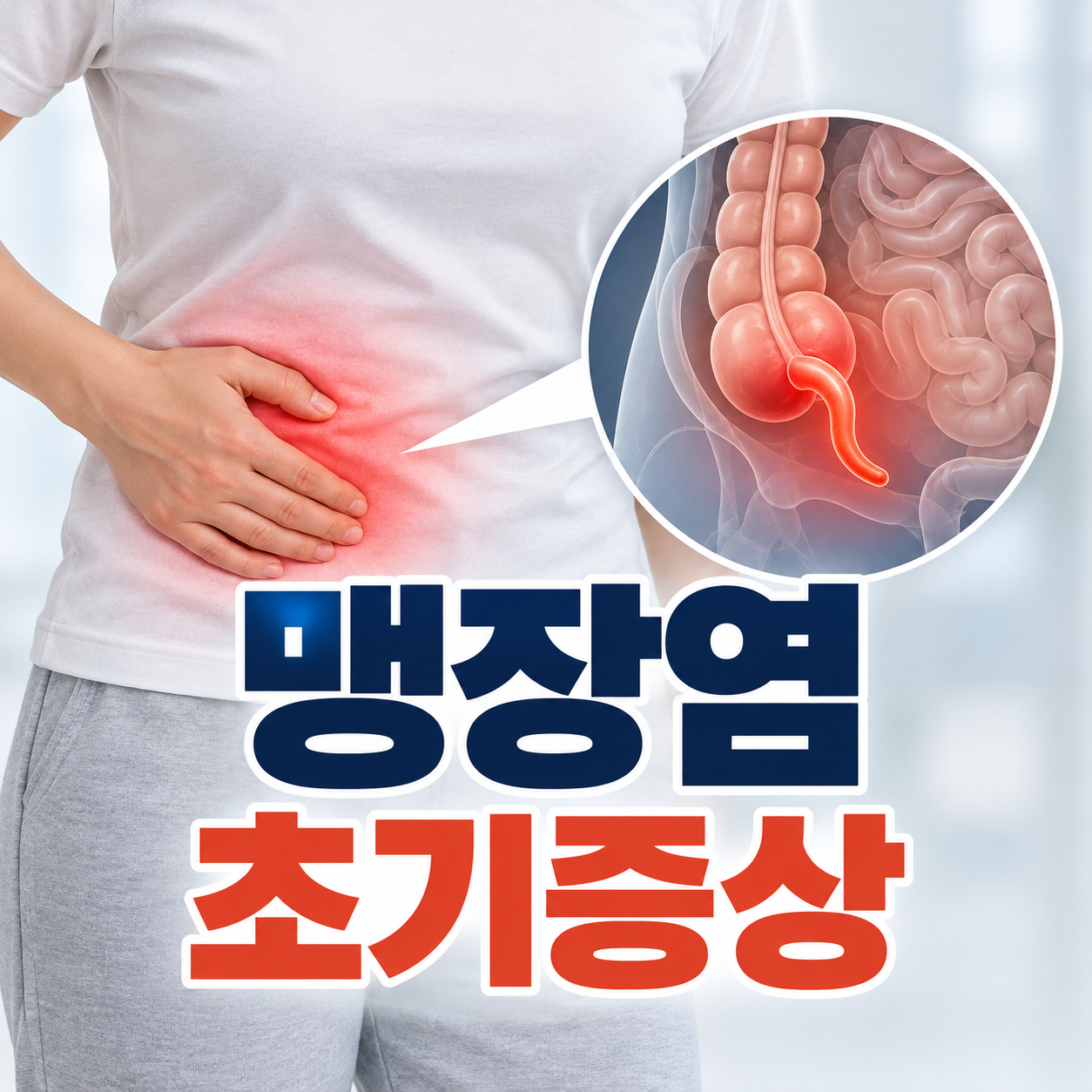 맹장염 초기증상