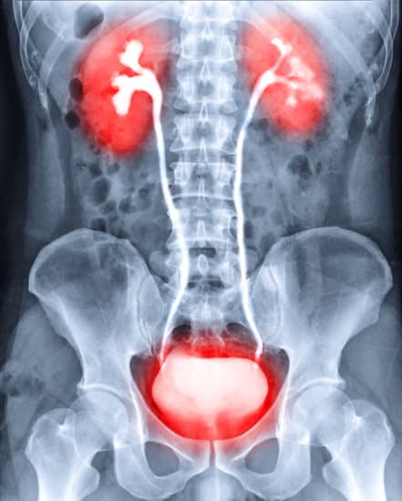 배뇨성 방광요도조영술