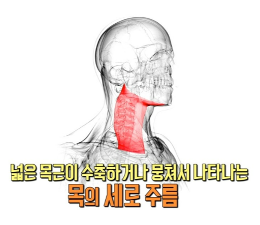 목 주름 피부 노화 예방 방법