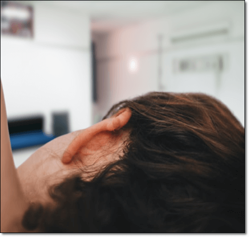 귀 표피낭종 치료