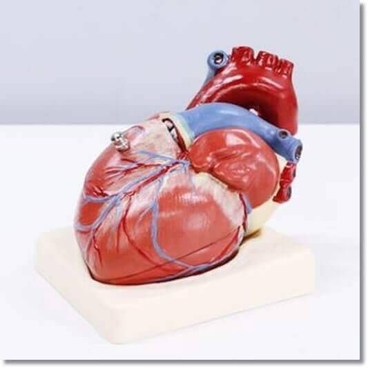 심장 모형