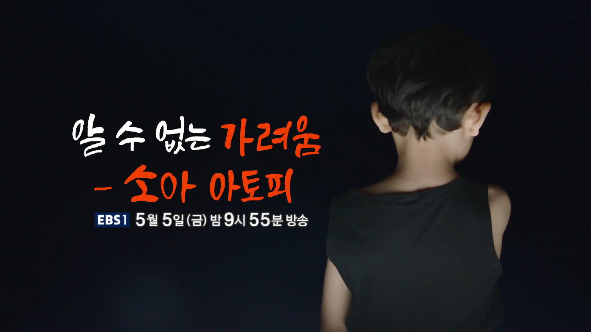 명의 어린이 소아 아토피 피부염 스테로이드 효과 및 부작용 완치 치료제 신약 비용 방법