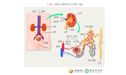 만성신부전