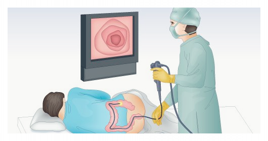 대장내시경-전-음식주의사항 