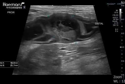 강아지 복막염 원인과 치료 방법_7