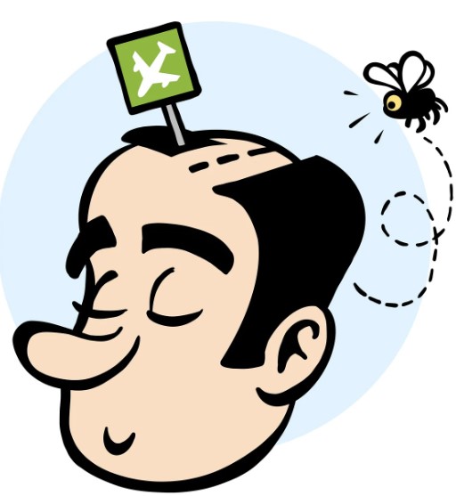 남성 탈모 원인과 치료 방법