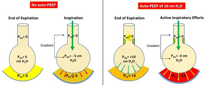 inspiration pressure gradient