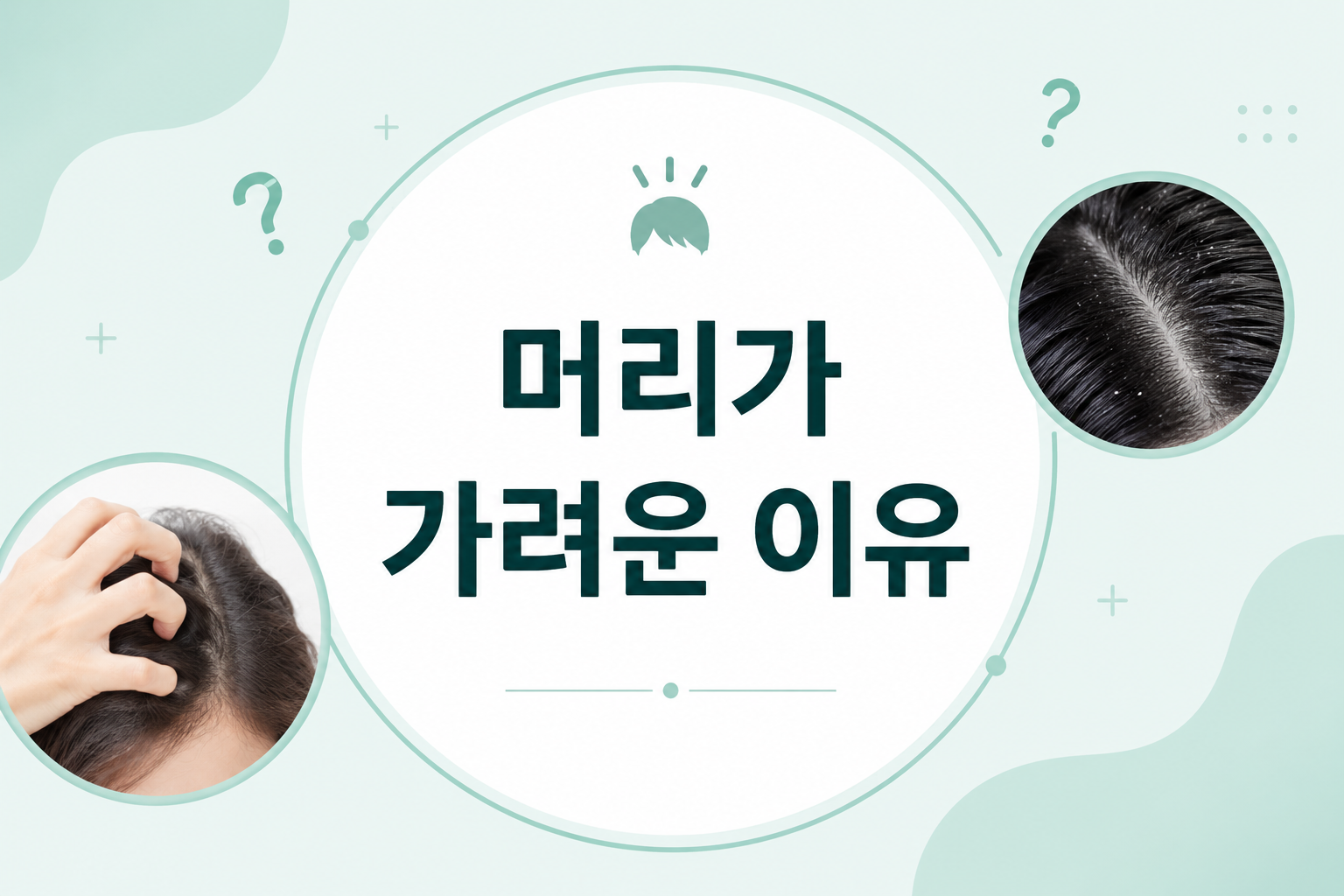 머리가 가려운 이유