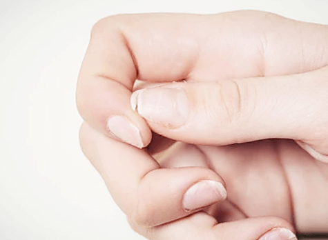 깨진-엄지-손가락