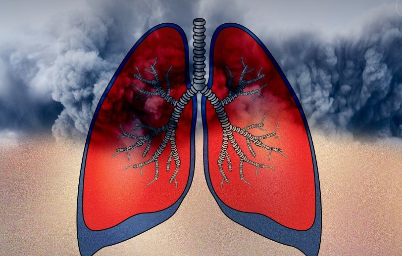 미세먼지가 호흡기에 좋지 않다는 관련된 모습