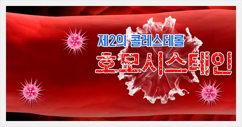 호모시스테인이란?