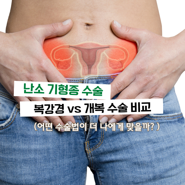 난소 기형종 수술법 비교