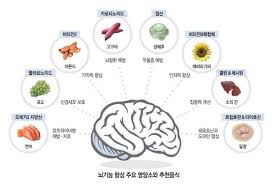 치매에 좋은 음식