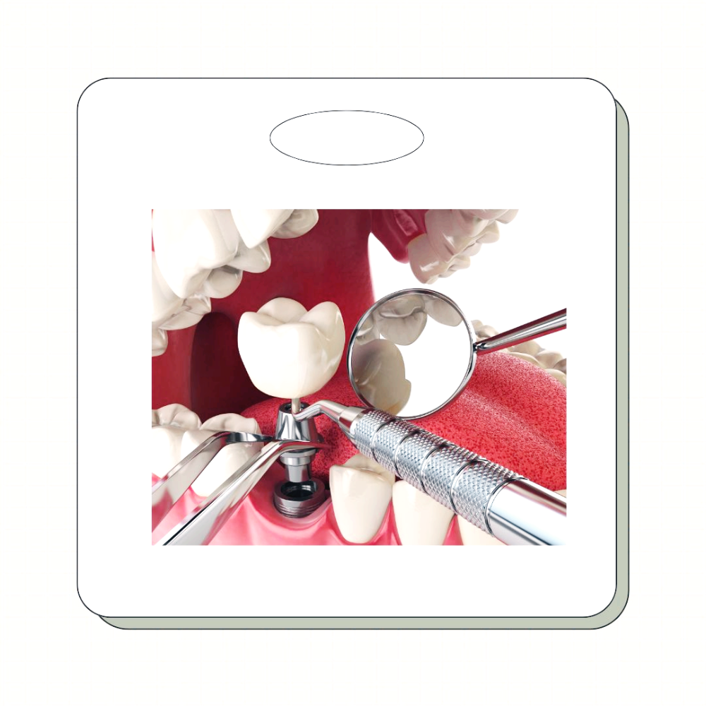 고령자 임플란트 건강보험 