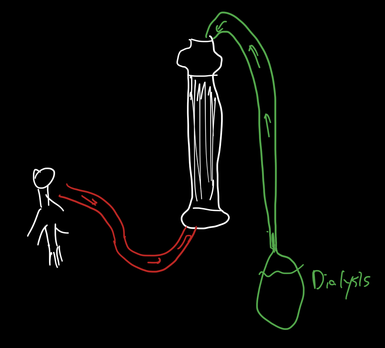 Dialysis