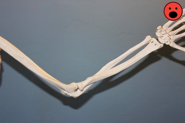 관절 통증 완화 운동