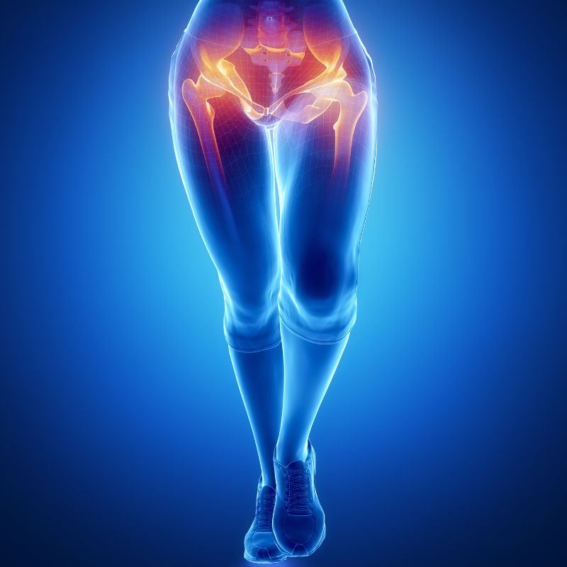 엉덩이 바깥쪽 통증