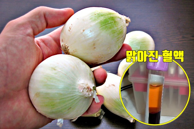 탁해진 피 고지혈증에 좋은 음식 양파 효능,팁줌
