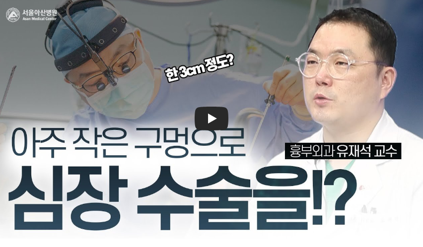 최소침습관상동맥우회술 심장수술 부천세종병원 협심증치료 건강정보