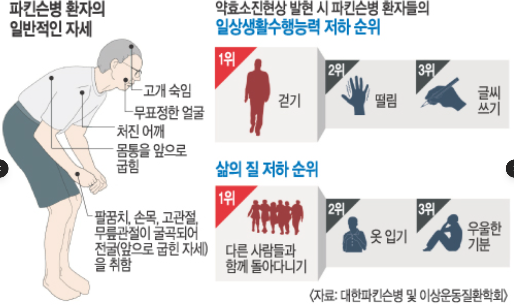 삼성가 이부진 사장 걸음걸이와 샤르코 마리 투스 유전병 팩트체크