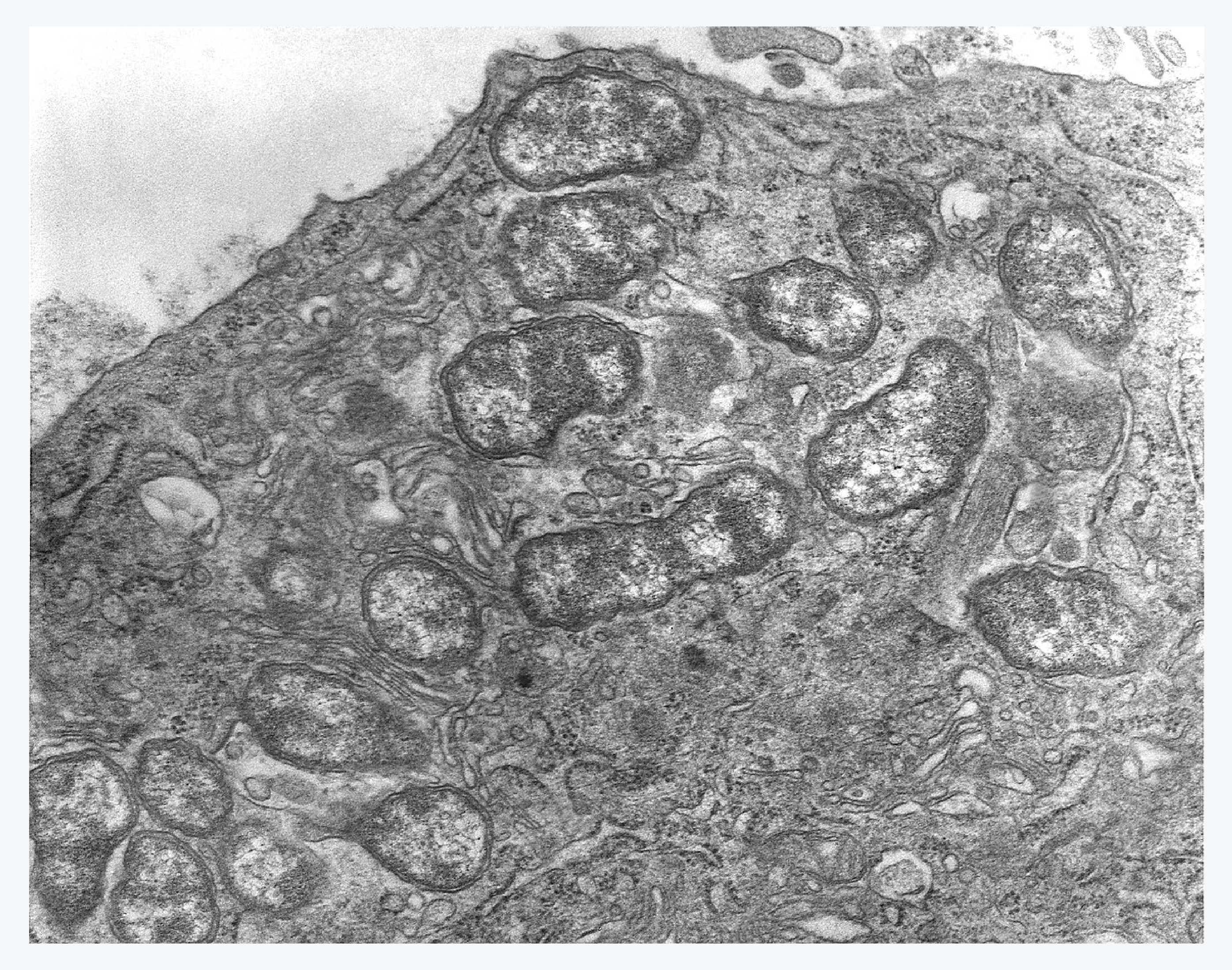 쯔쯔가무시, 진드기