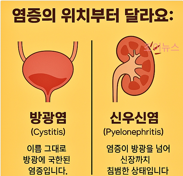 염증의 위치부터 다른 방광염과 신우신염