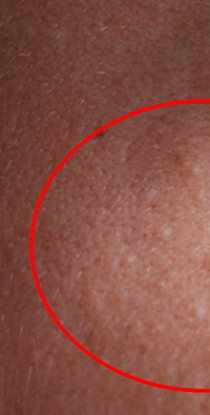 눈밑에 하얀 좁쌀