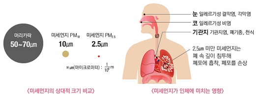 미세먼지의 호흡기 질환 영향 이미지