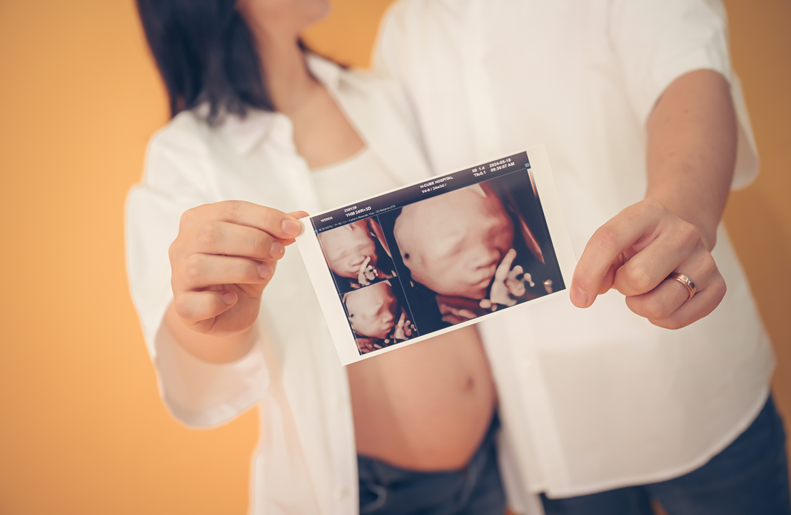 애니 스튜디오 노원 도봉점 만삭 사진 04