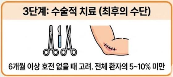 테니스 엘보 치료법