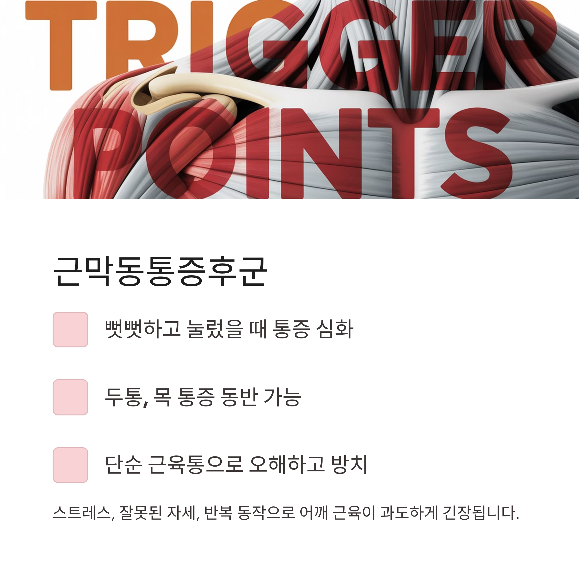 근막동통증후군의 통증 양상과 주요 증상을 보여주는 어깨 근육 해부 이미지