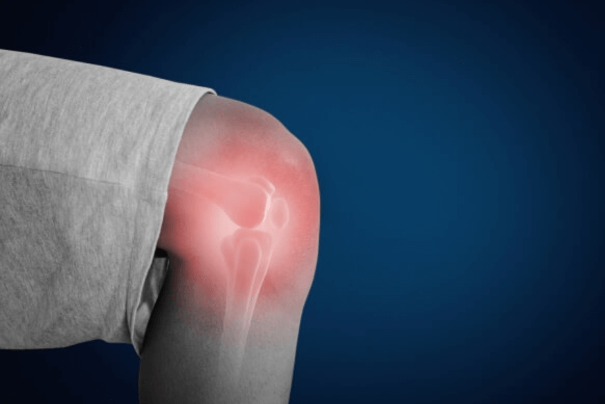 콘드로이친-많은음식