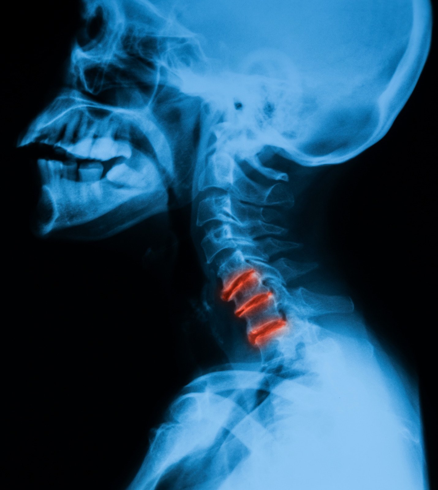 목통증의 원인과 증상