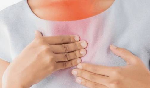 위산 역류 증상