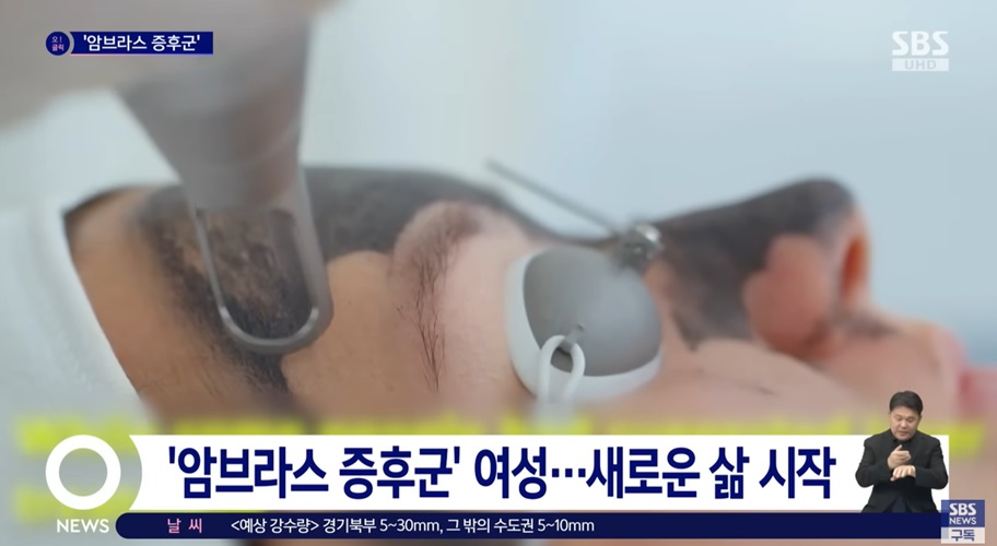 다모증 치료 후 변화