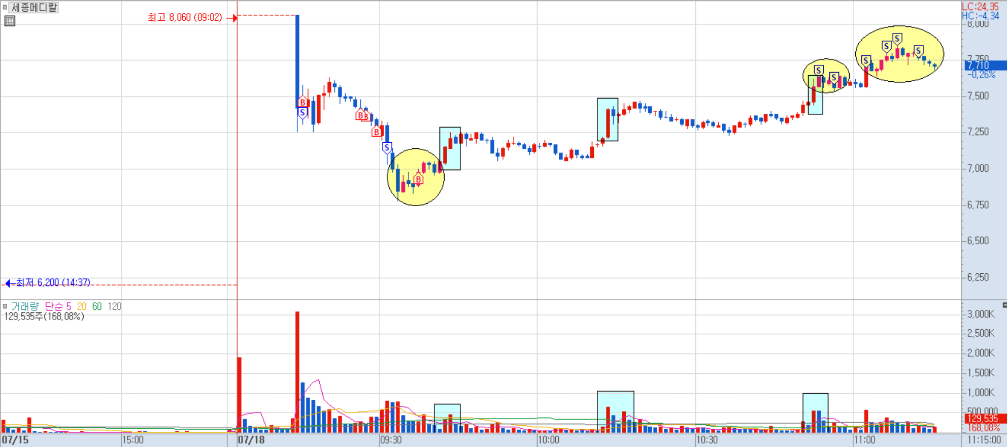 세종메디칼 분봉 차트 3)