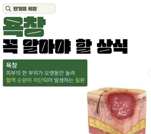 욕창을 각 나라에서 일컫는 명칭