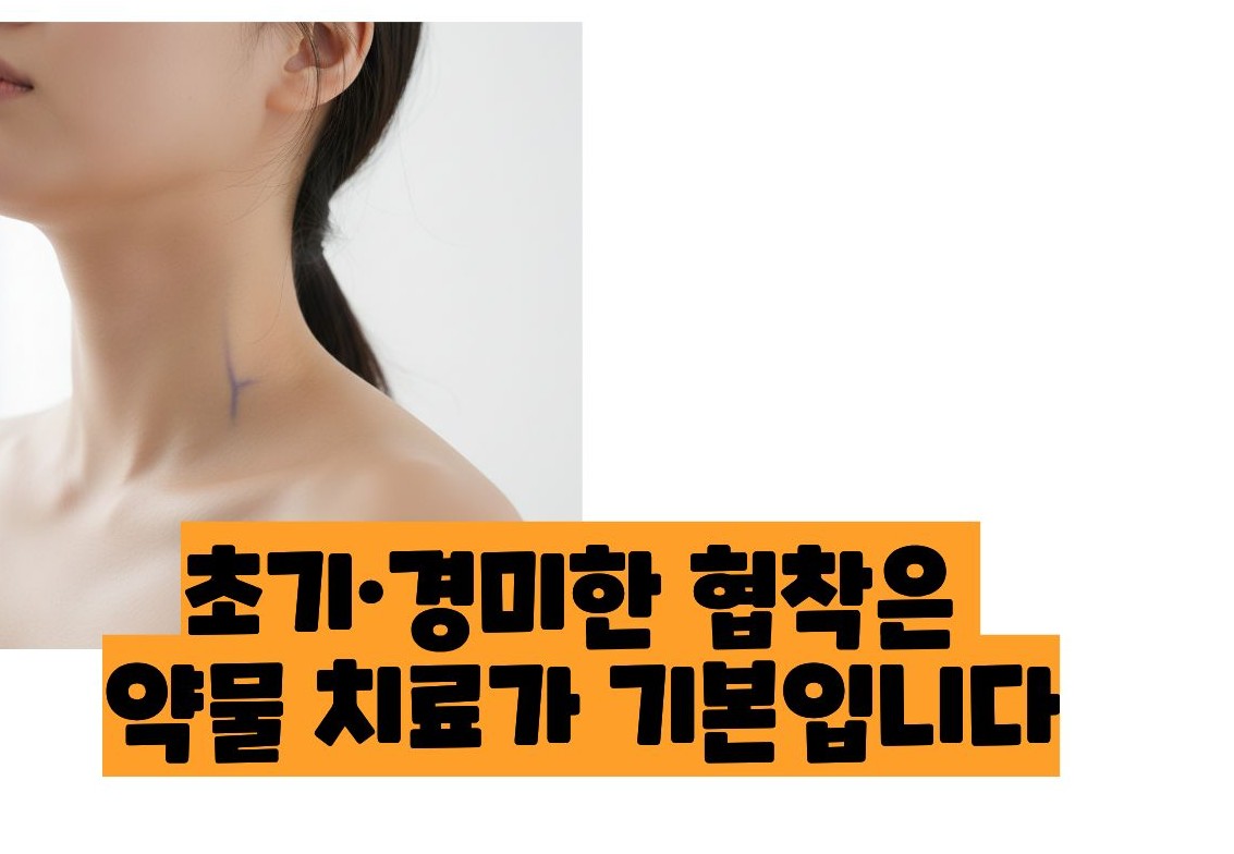 경동맥 협착증 치료