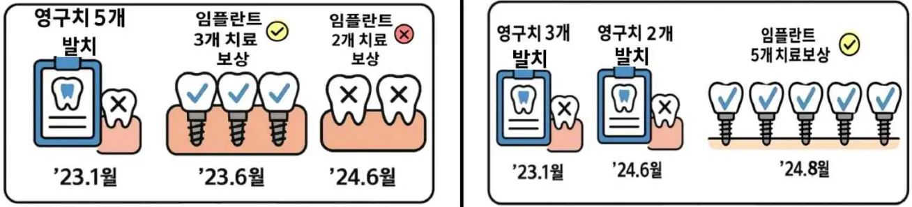임플란트 치료 보장 예시